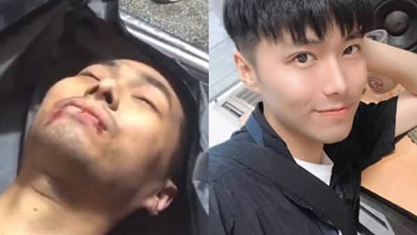 Nella foto: Pang Xun dopo due anni di torture sul letto della morte (S); Pang Xun nel 2020 prima che il PCC lo arrestasse perché praticava il Falun Gong (D).
